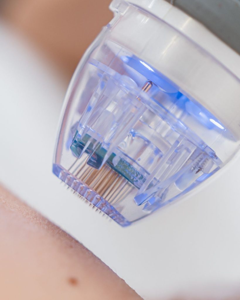 Radiofrequency Microneedling - Needle | Mizu