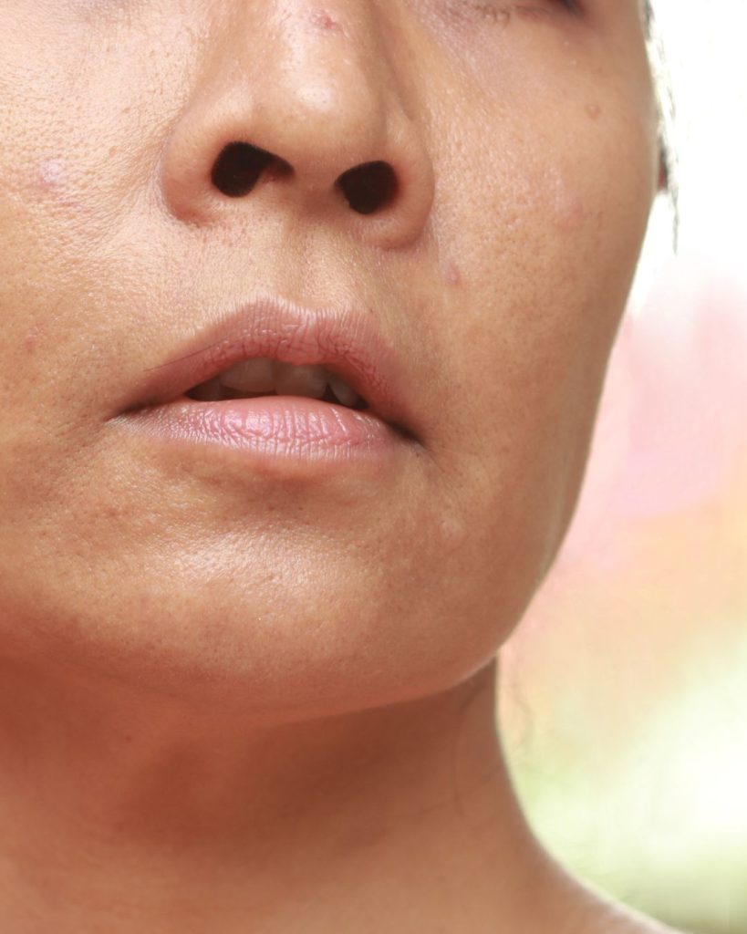Dull Skin | Mizu