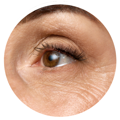 Dark Circles Concerns_Structural | Mizu