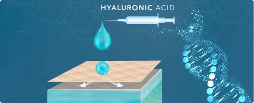 Skin Boosters for Hydration - Hyaluronic Acid Illustration | Mizu