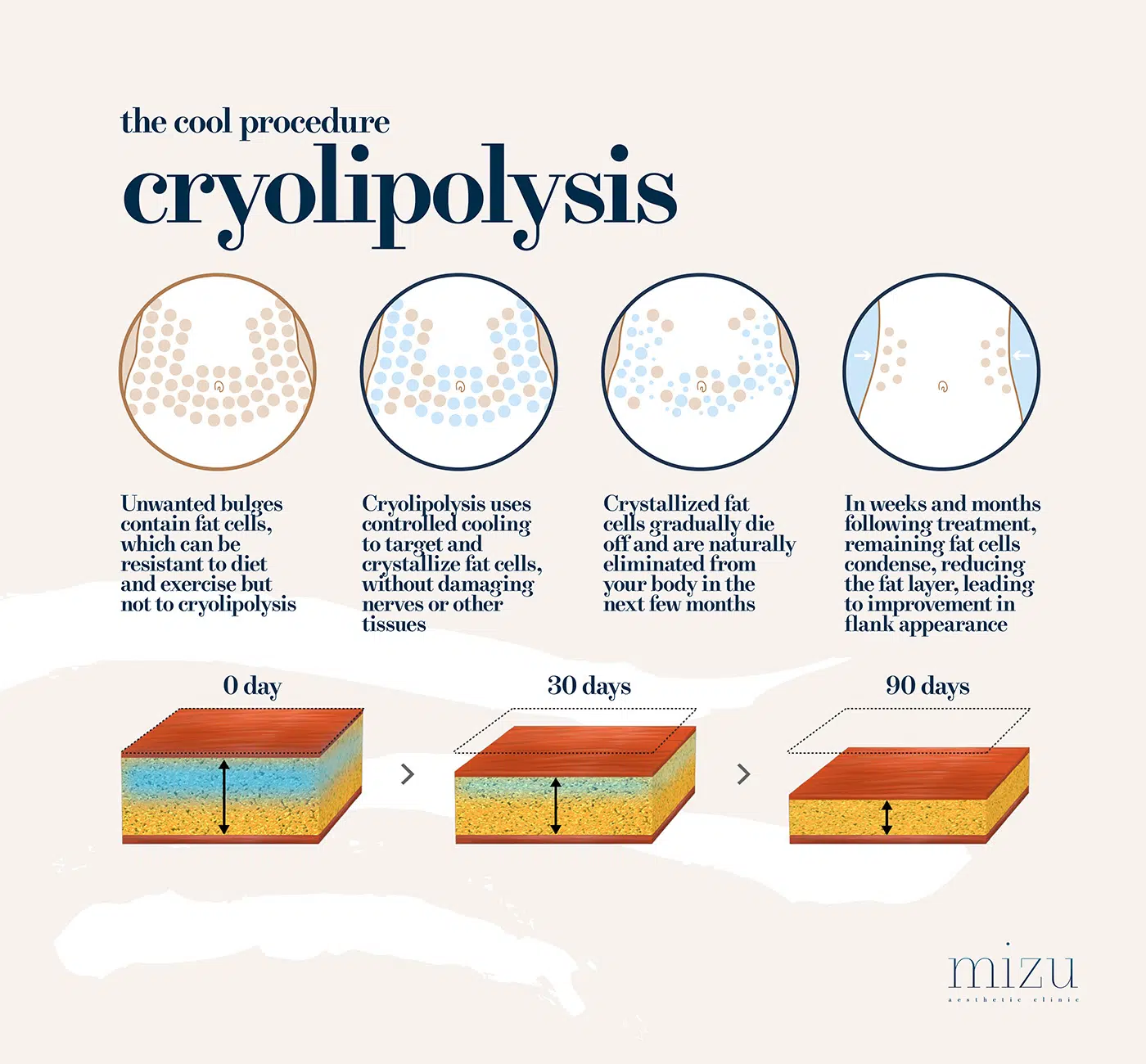 Cooltech Fat Freezing Treatment | Mizu