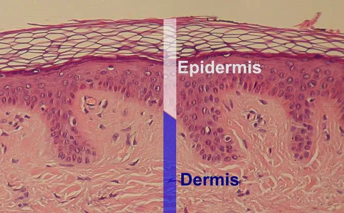 Skin Pigmentation: Epidermis vs Dermis | Mizu
