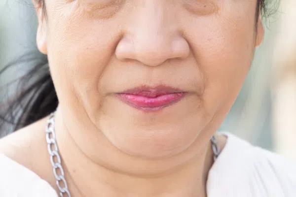 Skin Lifting Face Type | Mizu
